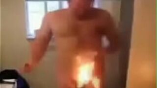 Человек сжигает себе нежелательные волосы - порно видео
